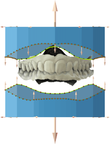 modulo ortodontico Maestro 3D