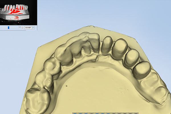 Shining 3D AutoScan DS-MIX facilita il lavoro dell'operatore