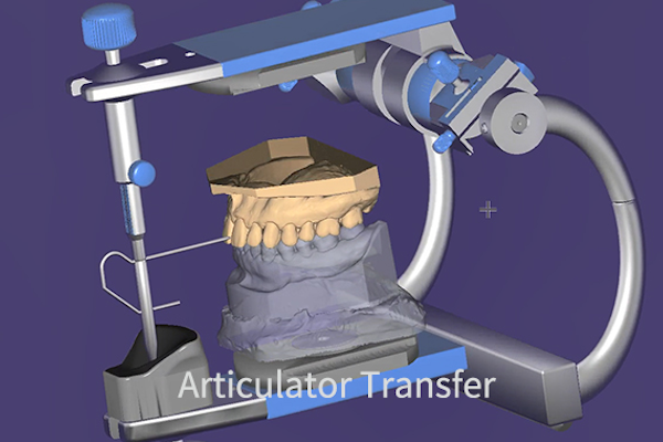 Shining 3D AutoScan DS-MIX permette il trasferimento delle info al CAD degli articolatori