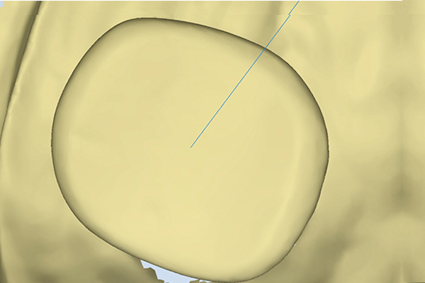 Shining 3D AutoScan DS-MIX, chiusura del canale direttamente nel software