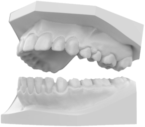 Resin3