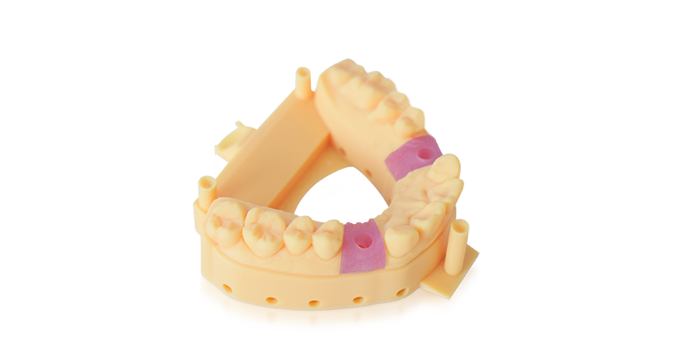 Gingiva-Mask