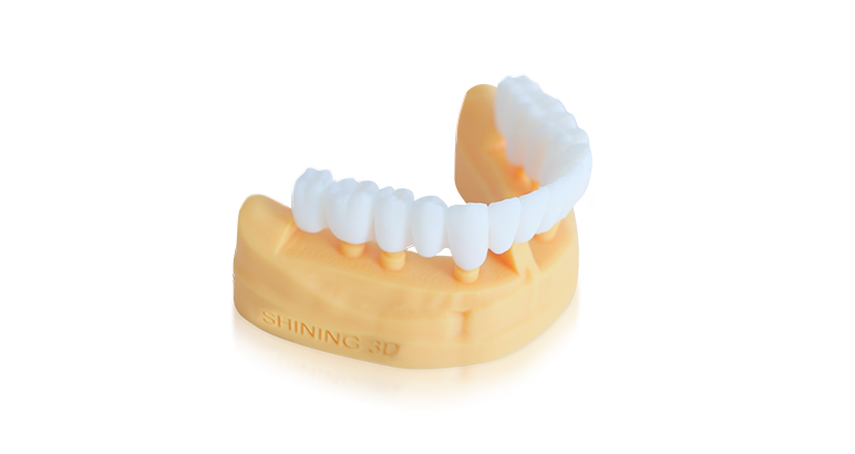 Implant-Try-on