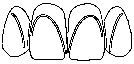 smile design