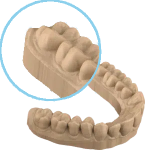sprintray-improved-dental-model-pro-3dprinter-290x300-1