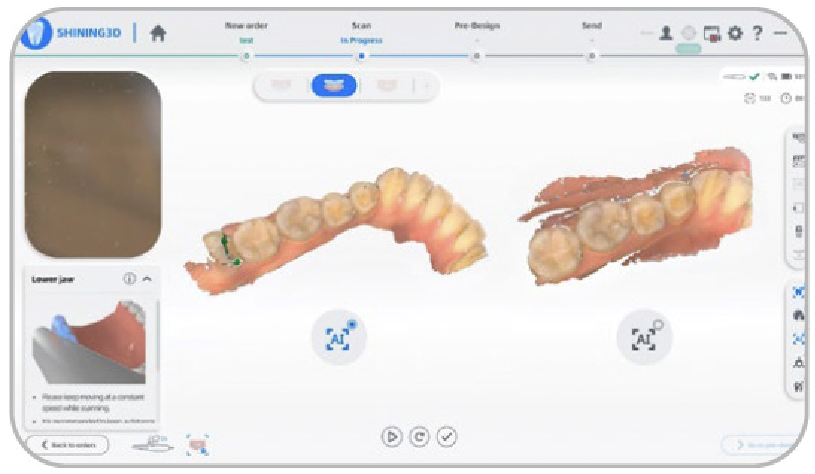 Aoralscan3 1 02 02