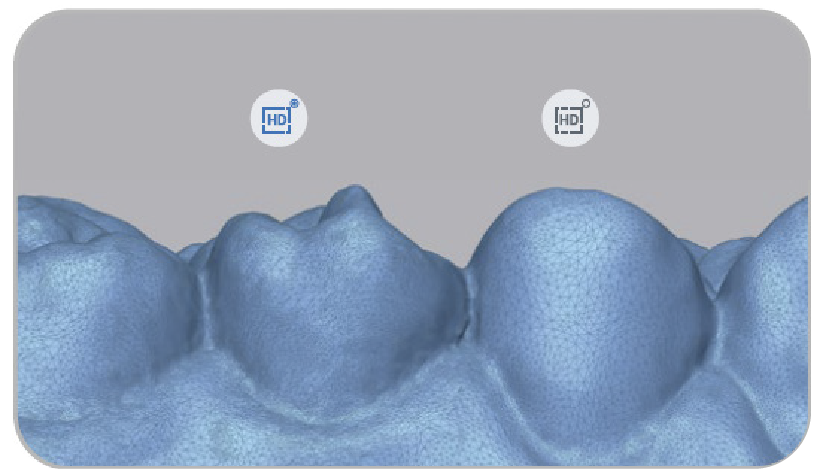 Aoralscan3 1 02 04