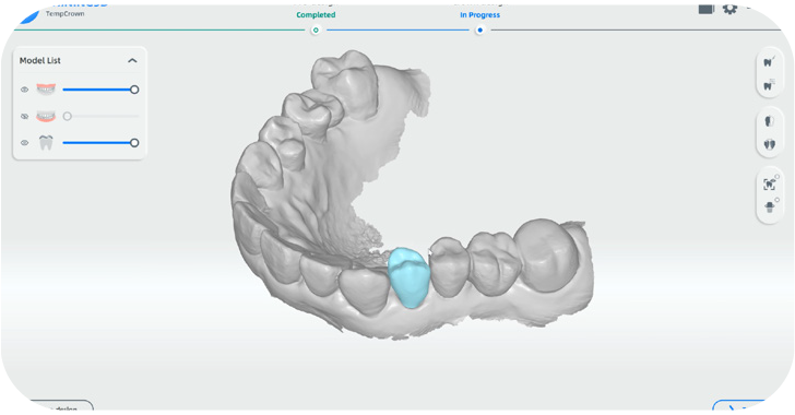 Aoralscan3 12 05