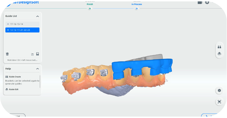 Aoralscan3 12 06