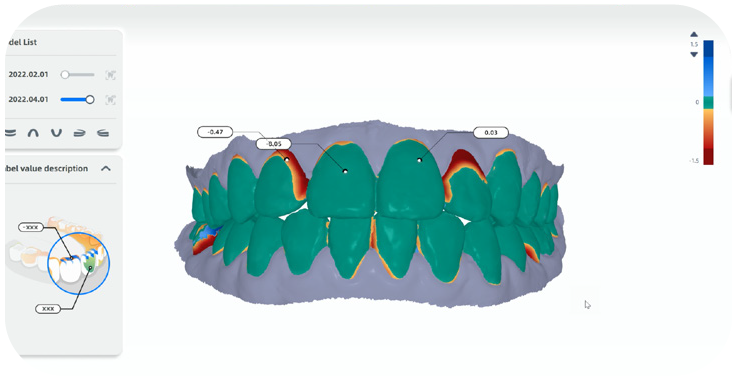 Aoralscan3 12 07