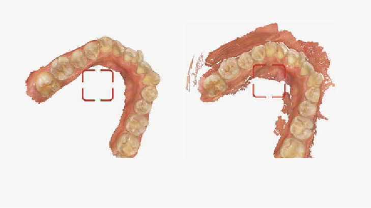 Home Aoralscan3 01 03