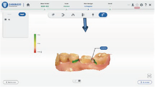 Home Aoralscan3 03 02