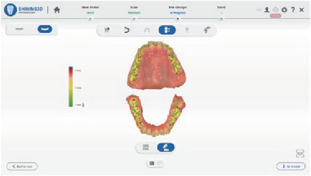 Home Aoralscan3 03 03