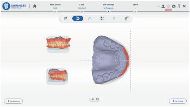 Home Aoralscan3 03 06