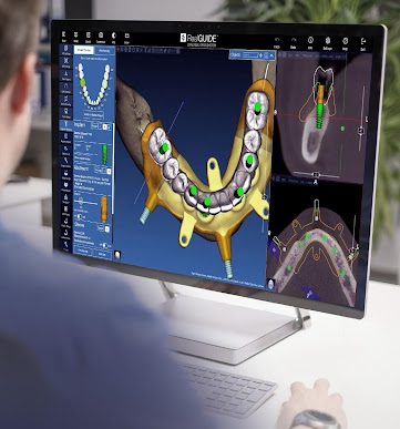 Realguide software dentale